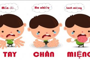 BÀI TUYÊN TRUYỀN PHÒNG CHỐNG DỊCH BỆNH TAY CHÂN MIỆNG